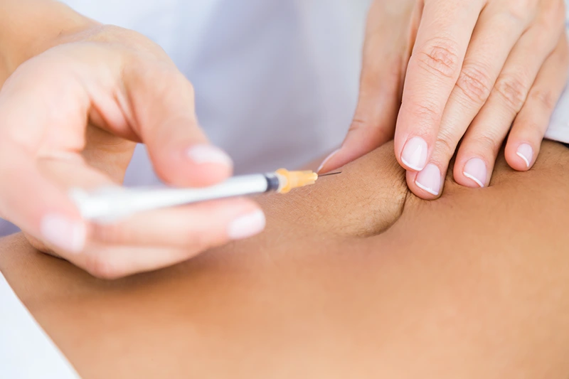 Lipoliz Mezoterapisi